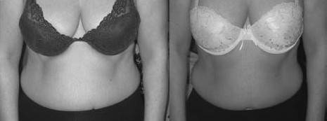 Иллюстрация к книге — Биогимнастика для лица: система фейсмионика [i_115.jpg]