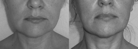 Иллюстрация к книге — Биогимнастика для лица: система фейсмионика [i_120.jpg]