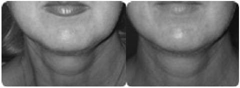 Иллюстрация к книге — Биогимнастика для лица: система фейсмионика [i_122.jpg]