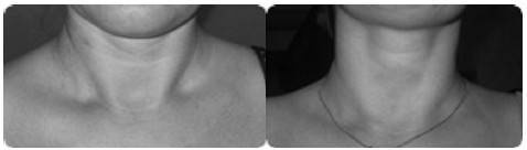 Иллюстрация к книге — Биогимнастика для лица: система фейсмионика [i_125.jpg]