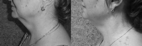 Иллюстрация к книге — Биогимнастика для лица: система фейсмионика [i_128.jpg]