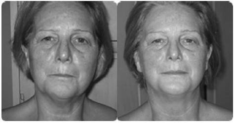 Иллюстрация к книге — Биогимнастика для лица: система фейсмионика [i_143.jpg]