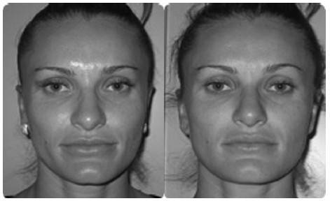 Иллюстрация к книге — Биогимнастика для лица: система фейсмионика [i_145.jpg]