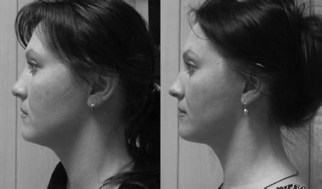 Иллюстрация к книге — Биогимнастика для лица: система фейсмионика [i_146.jpg]