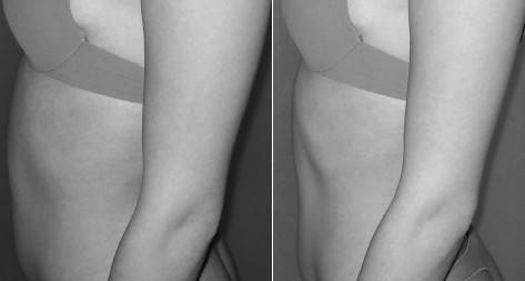 Иллюстрация к книге — Биогимнастика для лица: система фейсмионика [i_148.jpg]