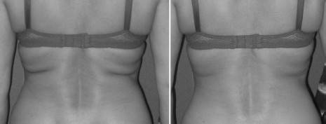 Иллюстрация к книге — Биогимнастика для лица: система фейсмионика [i_149.jpg]