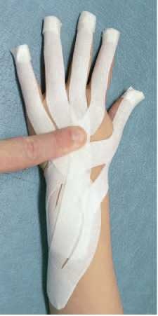 Иллюстрация к книге — Кинезиотейпинг в лечебной практике неврологии и ортопедии [i_001.jpg]