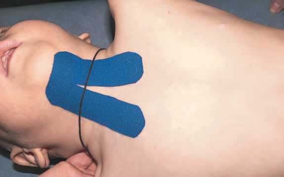 Иллюстрация к книге — Кинезиотейпинг в лечебной практике неврологии и ортопедии [i_010.jpg]