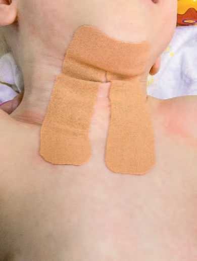 Иллюстрация к книге — Кинезиотейпинг в лечебной практике неврологии и ортопедии [i_011.jpg]