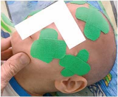 Иллюстрация к книге — Кинезиотейпинг в лечебной практике неврологии и ортопедии [i_018.jpg]