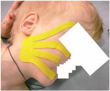 Иллюстрация к книге — Кинезиотейпинг в лечебной практике неврологии и ортопедии [i_019.jpg]