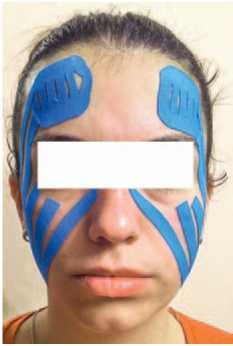 Иллюстрация к книге — Кинезиотейпинг в лечебной практике неврологии и ортопедии [i_021.jpg]