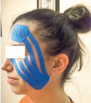 Иллюстрация к книге — Кинезиотейпинг в лечебной практике неврологии и ортопедии [i_022.jpg]