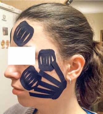 Иллюстрация к книге — Кинезиотейпинг в лечебной практике неврологии и ортопедии [i_024.jpg]