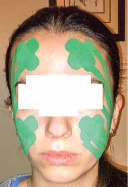 Иллюстрация к книге — Кинезиотейпинг в лечебной практике неврологии и ортопедии [i_025.jpg]