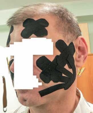 Иллюстрация к книге — Кинезиотейпинг в лечебной практике неврологии и ортопедии [i_027.jpg]