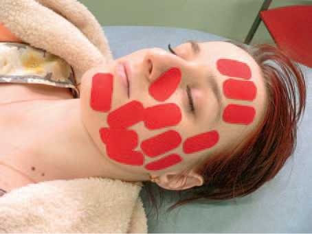 Иллюстрация к книге — Кинезиотейпинг в лечебной практике неврологии и ортопедии [i_028.jpg]