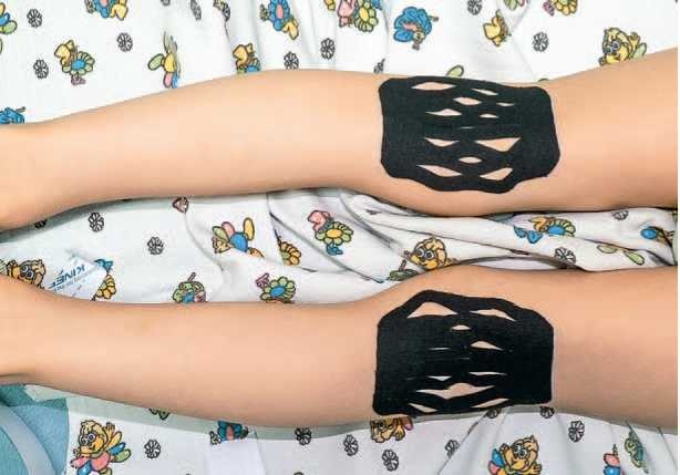 Иллюстрация к книге — Кинезиотейпинг в лечебной практике неврологии и ортопедии [i_034.jpg]