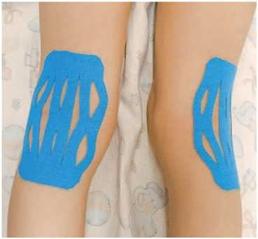 Иллюстрация к книге — Кинезиотейпинг в лечебной практике неврологии и ортопедии [i_040.jpg]