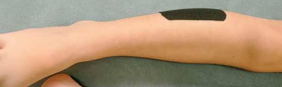 Иллюстрация к книге — Кинезиотейпинг в лечебной практике неврологии и ортопедии [i_045.jpg]