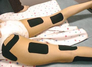 Иллюстрация к книге — Кинезиотейпинг в лечебной практике неврологии и ортопедии [i_048.jpg]