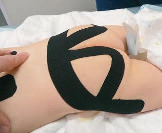 Иллюстрация к книге — Кинезиотейпинг в лечебной практике неврологии и ортопедии [i_049.jpg]