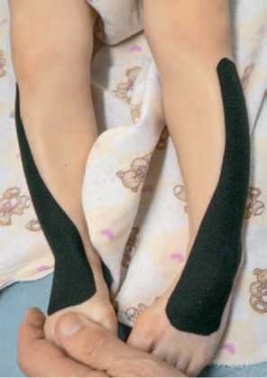 Иллюстрация к книге — Кинезиотейпинг в лечебной практике неврологии и ортопедии [i_054.jpg]