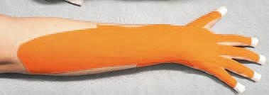 Иллюстрация к книге — Кинезиотейпинг в лечебной практике неврологии и ортопедии [i_061.jpg]