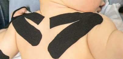 Иллюстрация к книге — Кинезиотейпинг в лечебной практике неврологии и ортопедии [i_066.jpg]