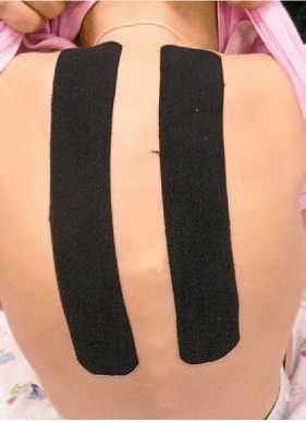 Иллюстрация к книге — Кинезиотейпинг в лечебной практике неврологии и ортопедии [i_069.jpg]