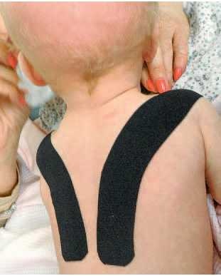 Иллюстрация к книге — Кинезиотейпинг в лечебной практике неврологии и ортопедии [i_070.jpg]