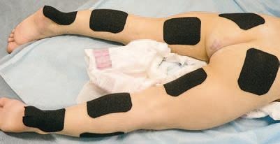 Иллюстрация к книге — Кинезиотейпинг в лечебной практике неврологии и ортопедии [i_072.jpg]