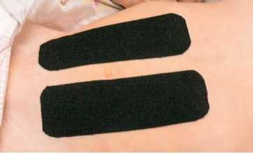 Иллюстрация к книге — Кинезиотейпинг в лечебной практике неврологии и ортопедии [i_073.jpg]