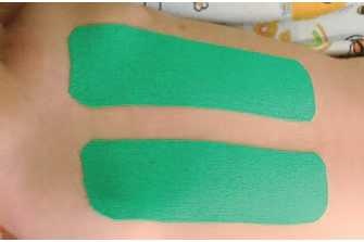 Иллюстрация к книге — Кинезиотейпинг в лечебной практике неврологии и ортопедии [i_074.jpg]