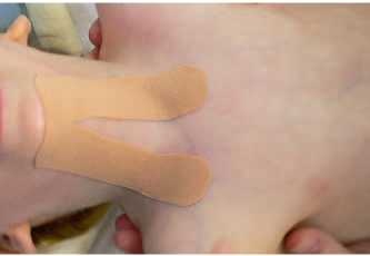 Иллюстрация к книге — Кинезиотейпинг в лечебной практике неврологии и ортопедии [i_076.jpg]