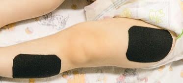 Иллюстрация к книге — Кинезиотейпинг в лечебной практике неврологии и ортопедии [i_077.jpg]