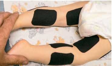 Иллюстрация к книге — Кинезиотейпинг в лечебной практике неврологии и ортопедии [i_079.jpg]