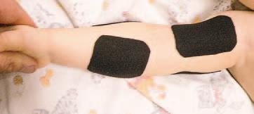 Иллюстрация к книге — Кинезиотейпинг в лечебной практике неврологии и ортопедии [i_081.jpg]