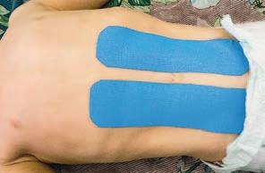 Иллюстрация к книге — Кинезиотейпинг в лечебной практике неврологии и ортопедии [i_084.jpg]