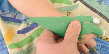 Иллюстрация к книге — Кинезиотейпинг в лечебной практике неврологии и ортопедии [i_085.jpg]