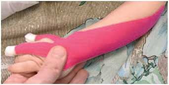 Иллюстрация к книге — Кинезиотейпинг в лечебной практике неврологии и ортопедии [i_086.jpg]