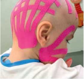 Иллюстрация к книге — Кинезиотейпинг в лечебной практике неврологии и ортопедии [i_089.jpg]