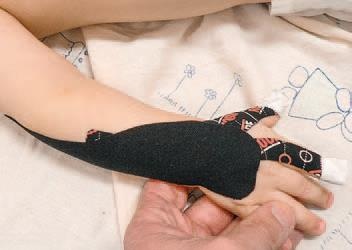 Иллюстрация к книге — Кинезиотейпинг в лечебной практике неврологии и ортопедии [i_097.jpg]