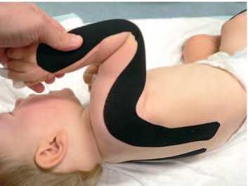 Иллюстрация к книге — Кинезиотейпинг в лечебной практике неврологии и ортопедии [i_105.jpg]