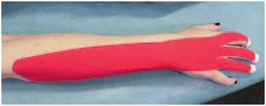 Иллюстрация к книге — Кинезиотейпинг в лечебной практике неврологии и ортопедии [i_106.jpg]