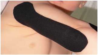 Иллюстрация к книге — Кинезиотейпинг в лечебной практике неврологии и ортопедии [i_107.jpg]