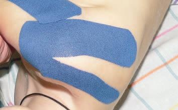 Иллюстрация к книге — Кинезиотейпинг в лечебной практике неврологии и ортопедии [i_108.jpg]