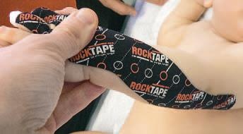 Иллюстрация к книге — Кинезиотейпинг в лечебной практике неврологии и ортопедии [i_111.jpg]