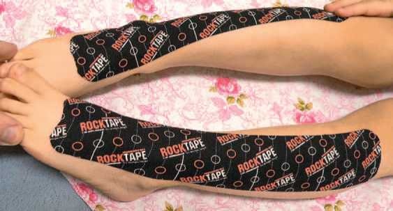 Иллюстрация к книге — Кинезиотейпинг в лечебной практике неврологии и ортопедии [i_117.jpg]