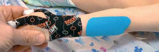 Иллюстрация к книге — Кинезиотейпинг в лечебной практике неврологии и ортопедии [i_126.jpg]